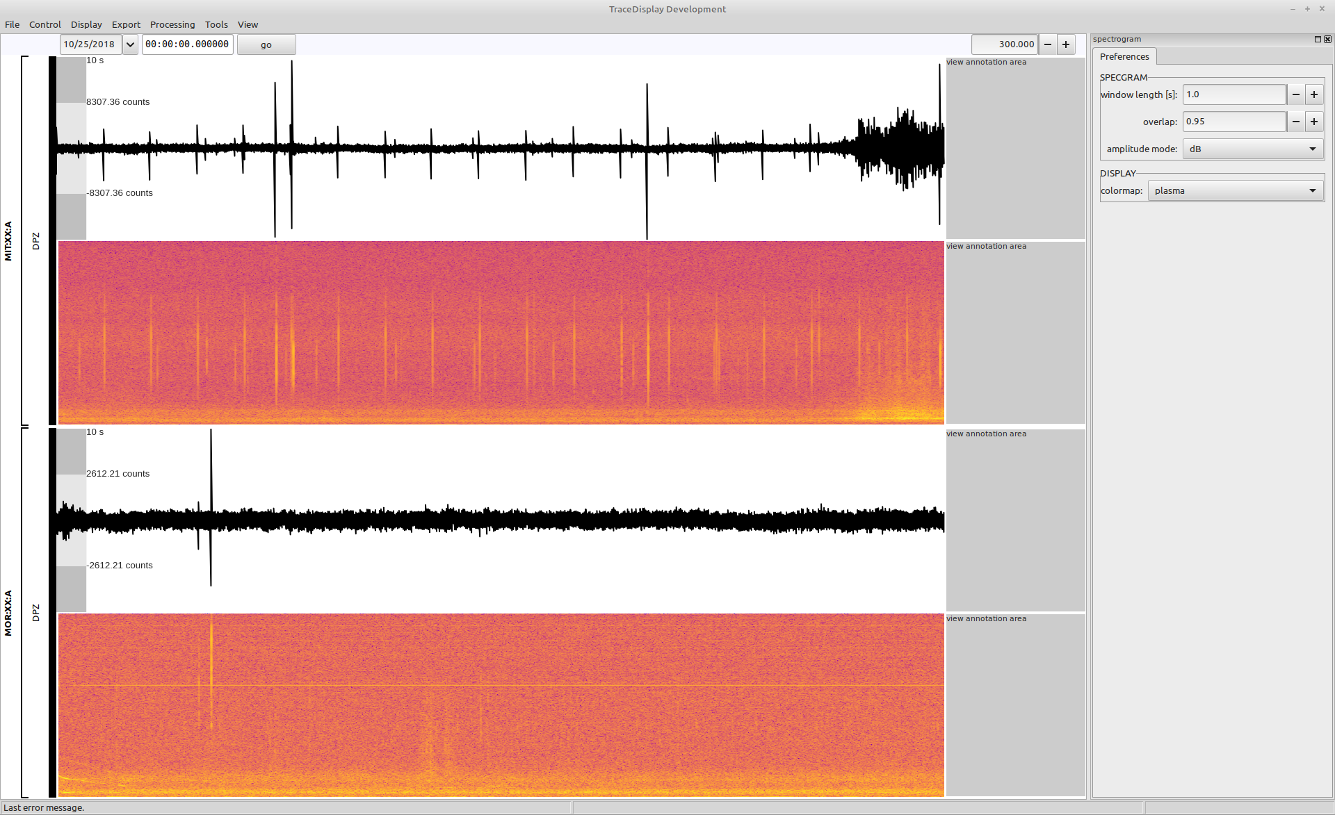 The spectrogram view with the changed colormap and overlap.
